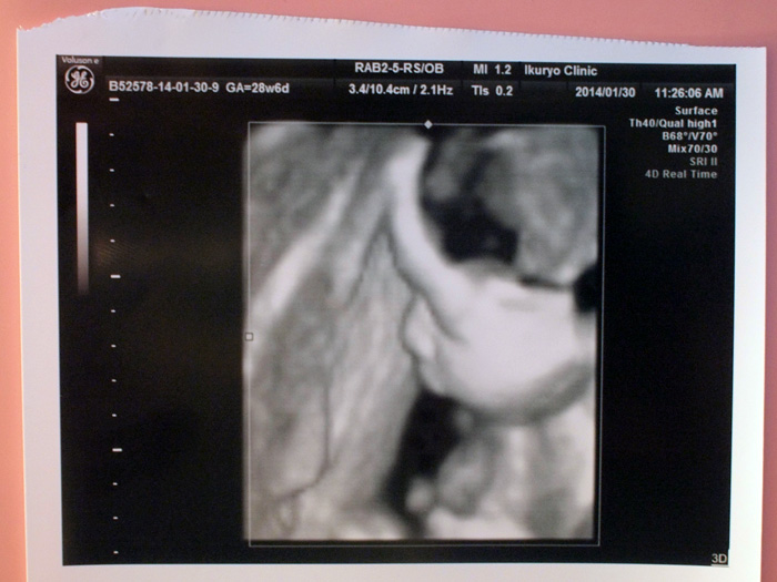 胎児の3Dエコー写真（妊娠28週）