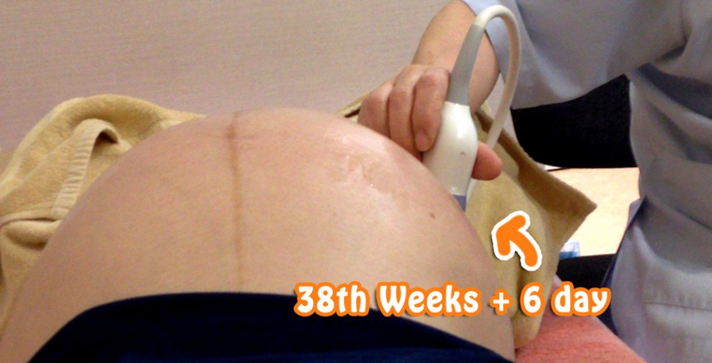 妊娠38週目と6日の巨大なお腹。エコーをあてて検査。