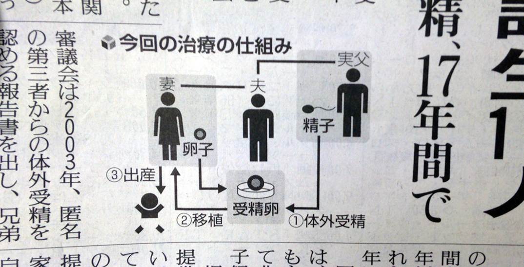 無精子の息子の代理に実父が精子提供。長野県の諏訪マタニティークリニックで118人出産。